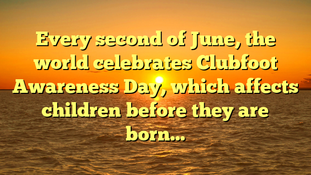 Every second of June, the world celebrates Clubfoot Awareness Day, which affects children before they are born…
